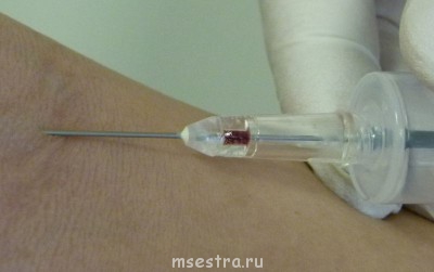 Метод Касаткина - 3.1.JPG