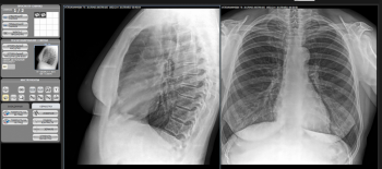 Исследования в рентгенологии - 1.png